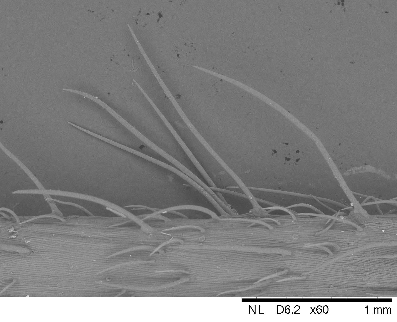 An electron microscope image of a normal trichome